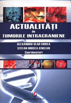 Actualitati-in-tumorile-intracraniene
