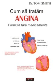 Angina