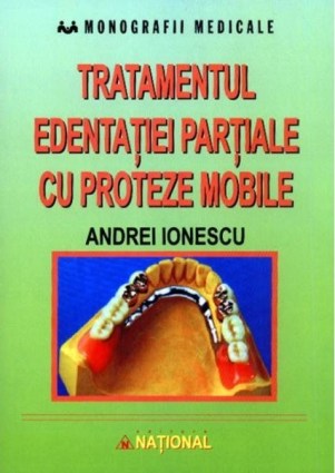 Tratamentul-edentaţiei-parţiale-cu-proteze-mobile