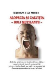 alopecia