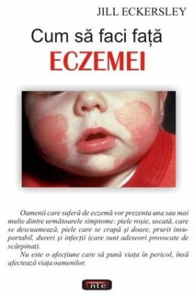 eczeme