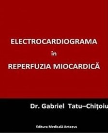 electrocardiograma