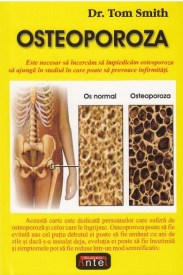 osteoporoza